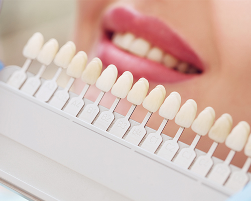 feature whitening
